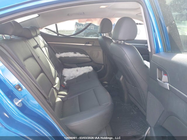KMHD84LF0JU567476 Hyundai Elantra Gls