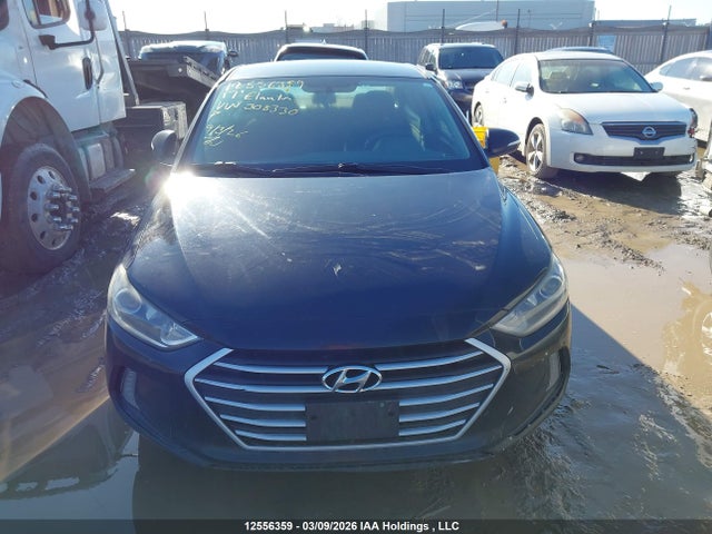 KMHD84LF1HU308330 Hyundai ELANTRA GL