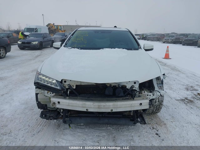 19UUB1F57FA801095 Acura TLX TECH