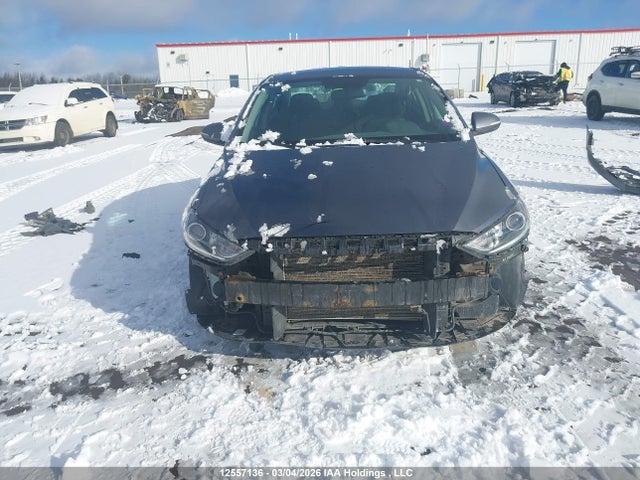 Продажа на аукционе авто 2017 Hyundai Elantra Se/value/limited, vin: KMHD84LF5HU184465, номер лота: 12557136