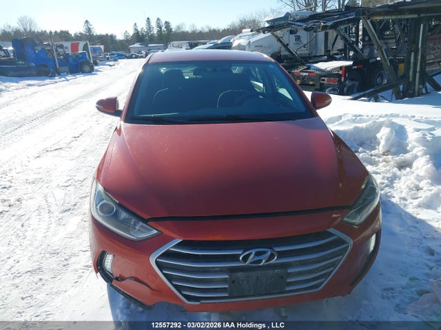 KMHD84LF0HU221793 Hyundai ELANTRA GL