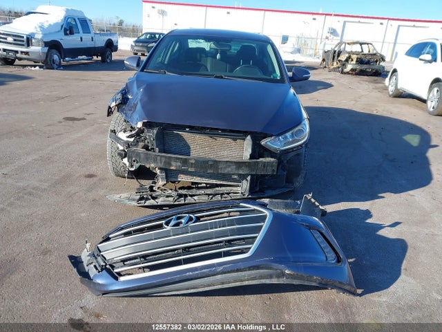 12557382 :رقم المزاد ، KMHD84LF6HU376106 vin ، 2017 Hyundai Elantra Gl مزاد بيع