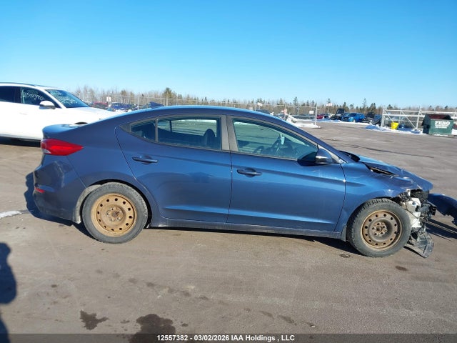 12557382 :رقم المزاد ، KMHD84LF6HU376106 vin ، 2017 Hyundai Elantra Gl مزاد بيع