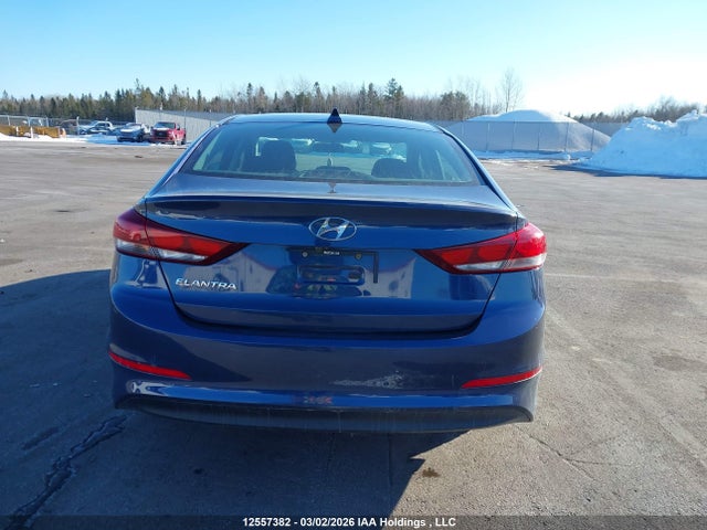 12557382 :رقم المزاد ، KMHD84LF6HU376106 vin ، 2017 Hyundai Elantra Gl مزاد بيع
