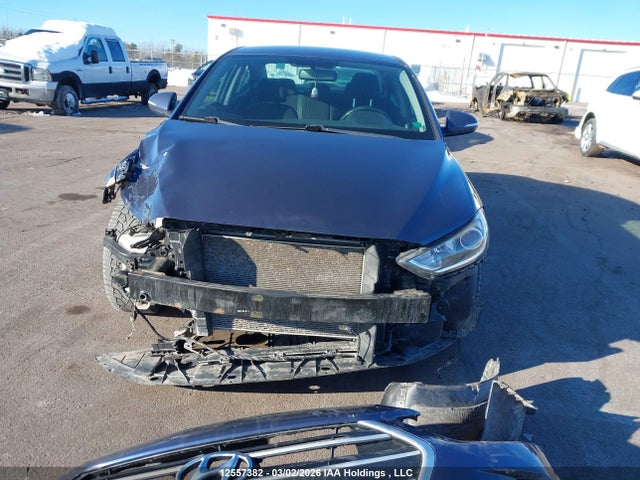 12557382 :رقم المزاد ، KMHD84LF6HU376106 vin ، 2017 Hyundai Elantra Gl مزاد بيع