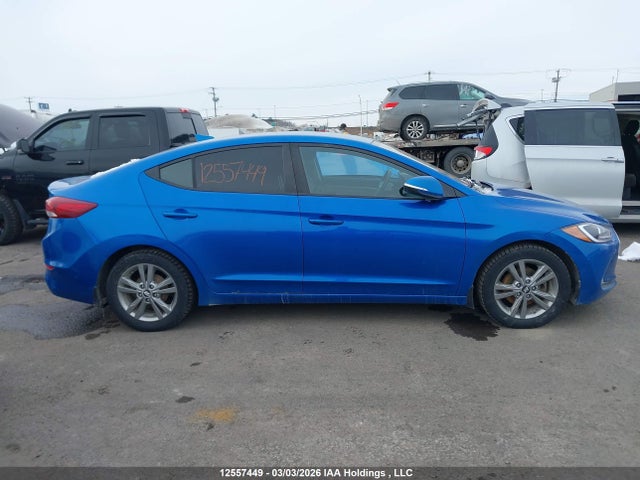 KMHD84LF8JU658219 Hyundai ELANTRA GL