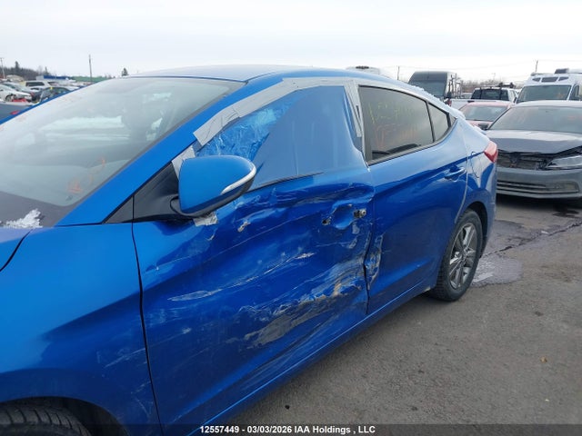 KMHD84LF8JU658219 Hyundai ELANTRA GL