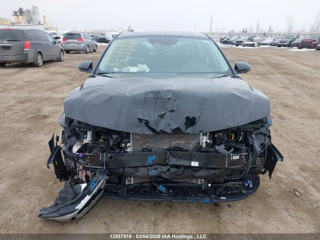 KMHLN4DJ1SU180637 Hyundai Elantra Limited