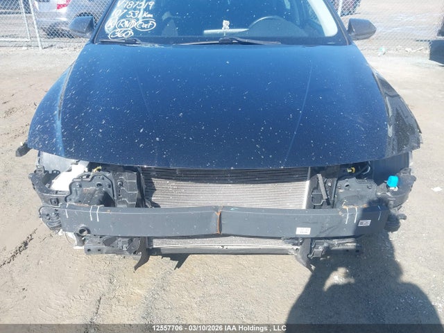KMHLM4AGXMU187519 Hyundai ELANTRA SEL