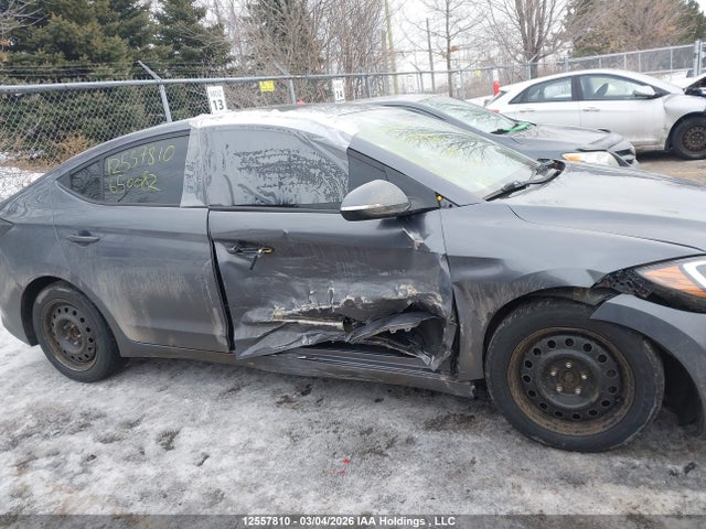 KMHD84LF0JU650082 Hyundai Elantra