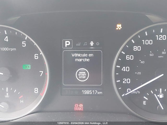 KMHD84LF0JU650082 Hyundai Elantra