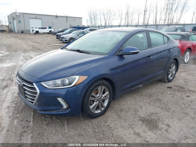 KMHD84LFXJU453615 Hyundai Elantra Sel/value/limited