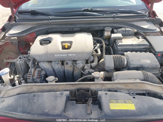 KMHD84LFXJU542519 Hyundai ELANTRA GL