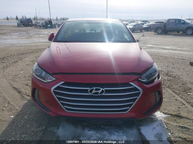 KMHD84LFXJU542519 Hyundai ELANTRA GL
