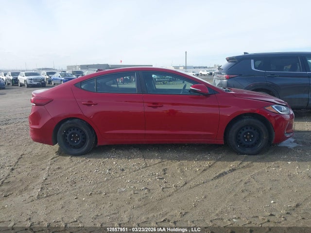 KMHD84LFXJU542519 Hyundai ELANTRA GL