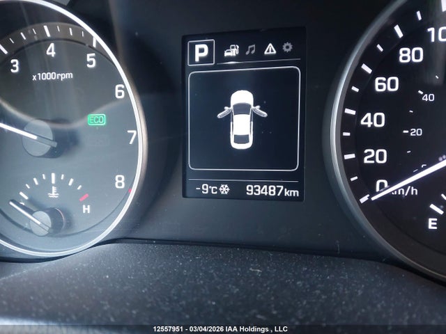 KMHD84LFXJU542519 Hyundai ELANTRA GL