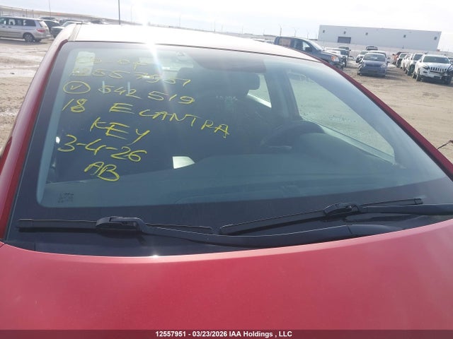 KMHD84LFXJU542519 Hyundai ELANTRA GL