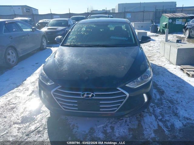 KMHD84LF2HU300480 Hyundai Elantra Se/value/limited