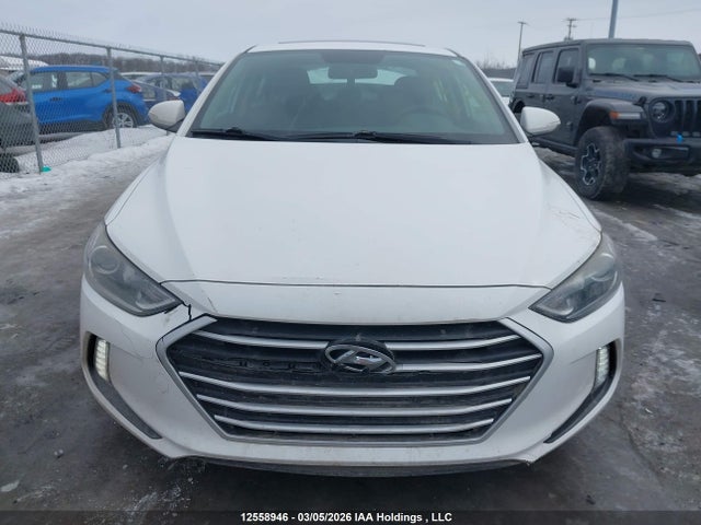 KMHD84LF1JU625997 Hyundai Elantra Sel/value/limited