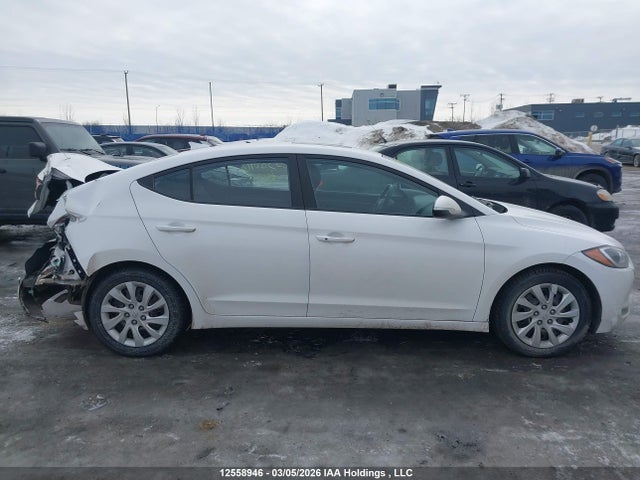 KMHD84LF1JU625997 Hyundai Elantra Sel/value/limited