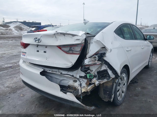 KMHD84LF1JU625997 Hyundai Elantra Sel/value/limited