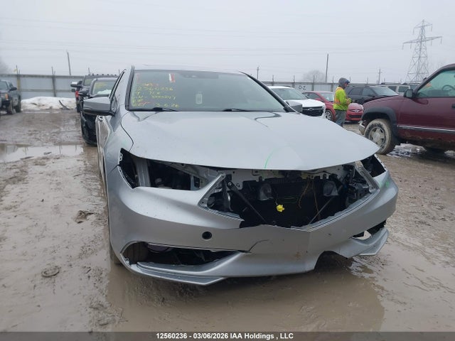 19UUB1F59KA800847 Acura Tlx Technology