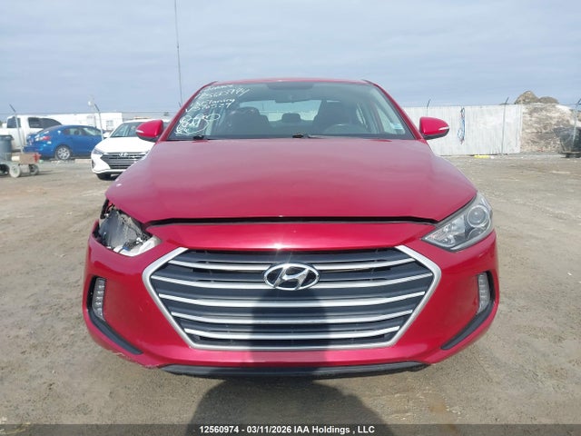 KMHD84LFXJU570529 Hyundai ELANTRA GL