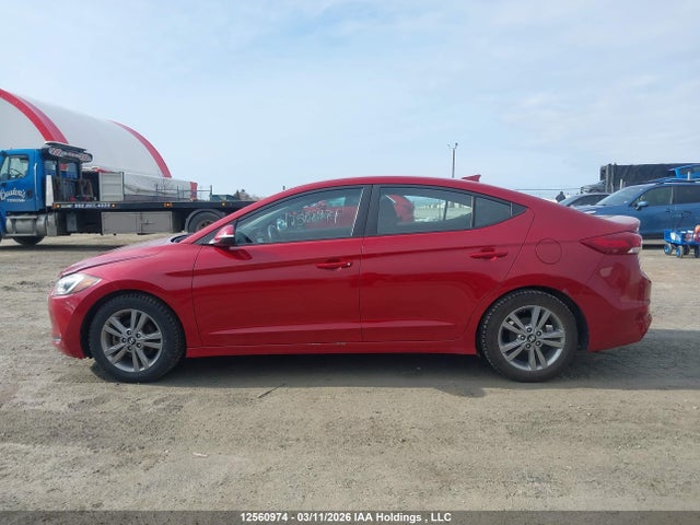 KMHD84LFXJU570529 Hyundai ELANTRA GL