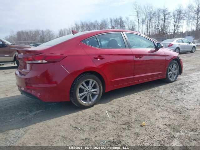 KMHD84LFXJU570529 Hyundai ELANTRA GL