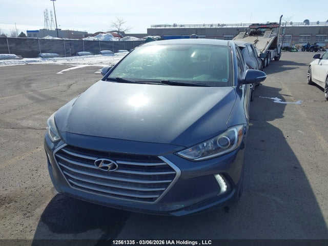 KMHD84LF4HU167155 Hyundai ELANTRA GL