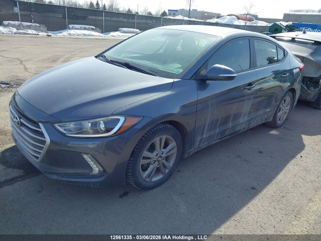 KMHD84LF4HU167155 Hyundai ELANTRA GL