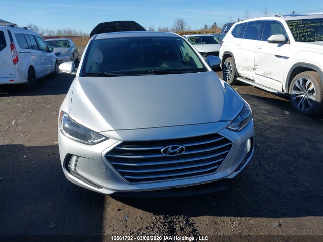 KMHD84LF4JU720036 Hyundai Elantra Gl Se