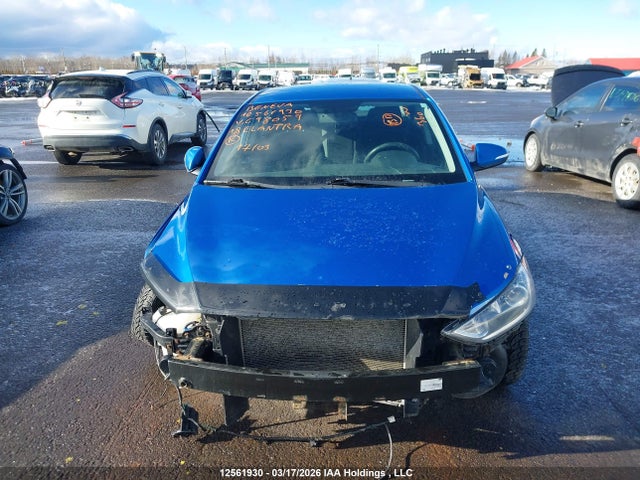 KMHD84LF3JU698059 Hyundai ELANTRA GL