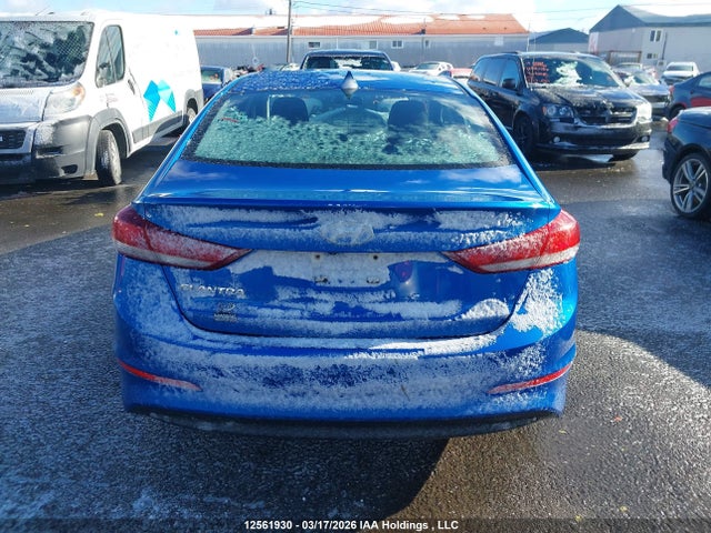 KMHD84LF3JU698059 Hyundai ELANTRA GL