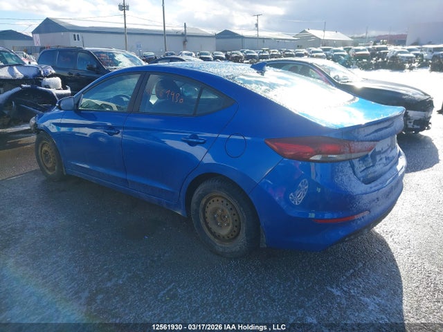 KMHD84LF3JU698059 Hyundai ELANTRA GL