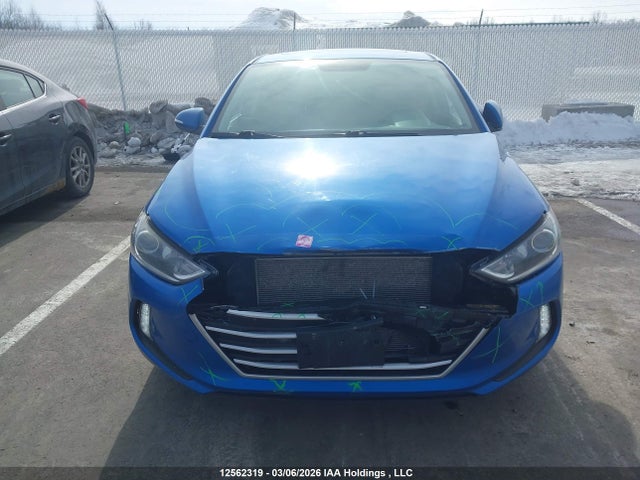 KMHD84LF7JU649267 Hyundai Elantra Gl Se