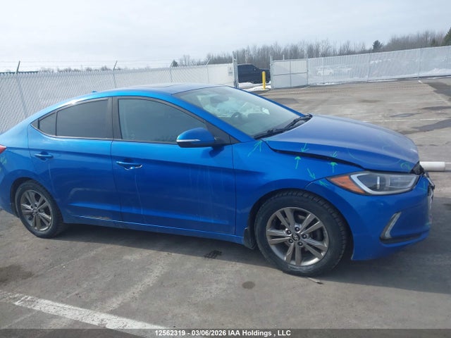 KMHD84LF7JU649267 Hyundai Elantra Gl Se