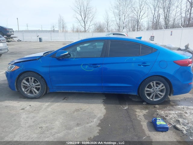 KMHD84LF7JU649267 Hyundai Elantra Gl Se