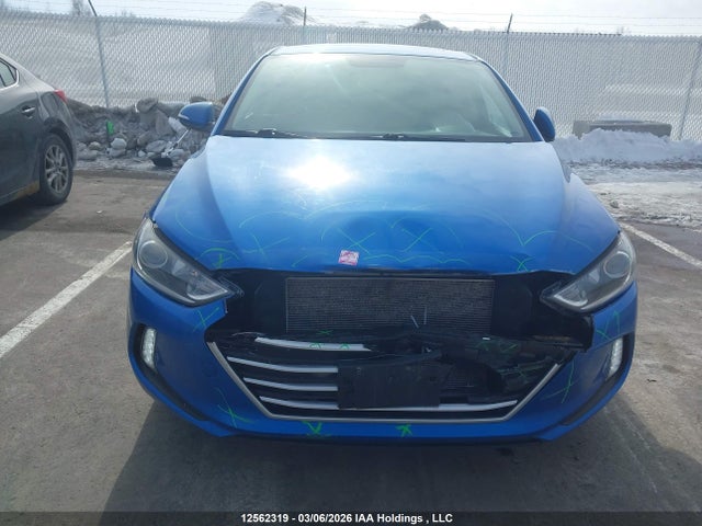 KMHD84LF7JU649267 Hyundai Elantra Gl Se