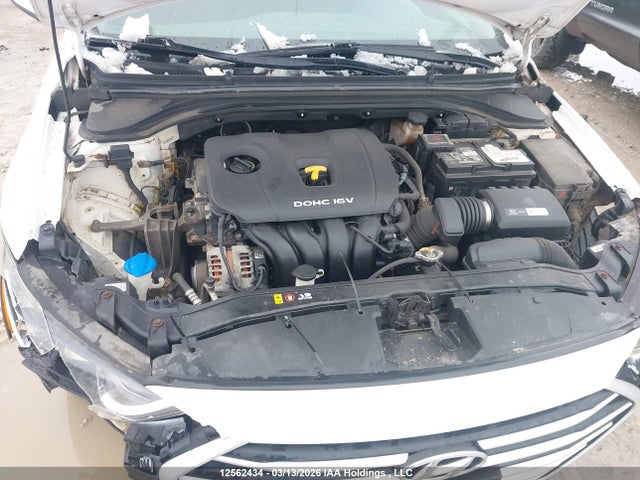 KMHD84LF2HU308692 Hyundai ELANTRA GL