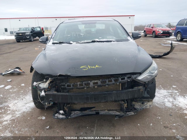 KMHD04LB6HU321935 Hyundai Elantra Sport
