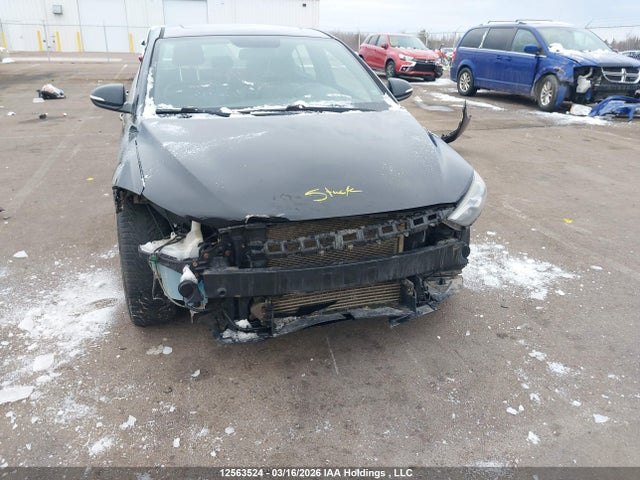 KMHD04LB6HU321935 Hyundai Elantra Sport