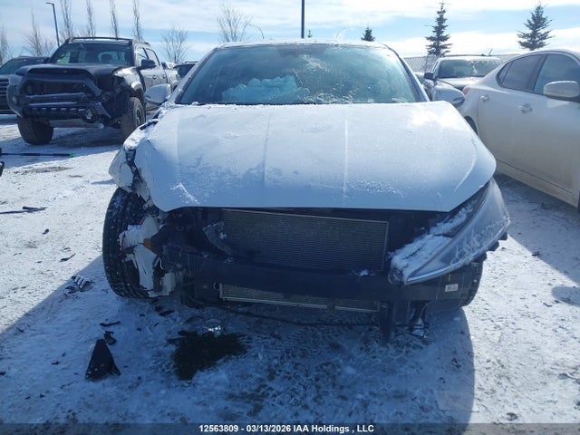 KMHD84LF4LU052550 Hyundai Elantra Sel/value/limited