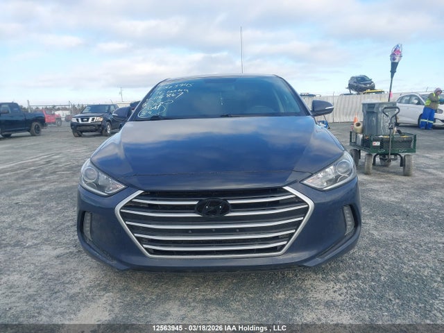 KMHD84LF4HU116867 Hyundai Elantra Gls