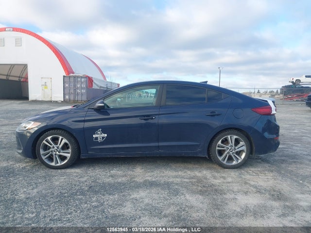 KMHD84LF4HU116867 Hyundai Elantra Gls