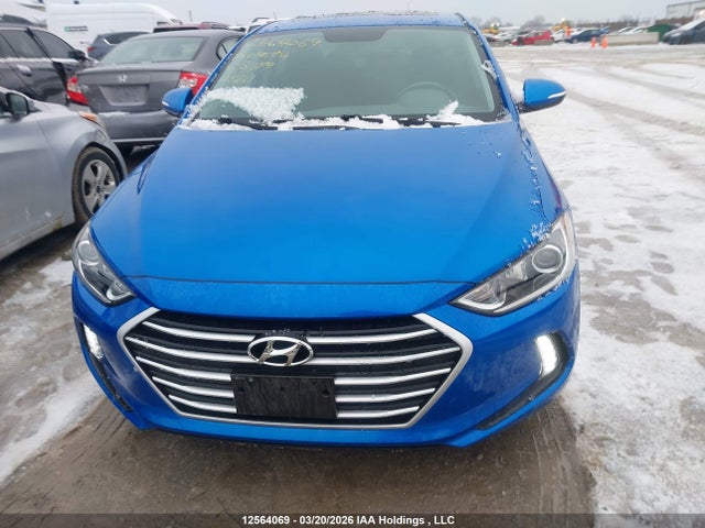 KMHD84LF4JU511279 Hyundai Elantra Sel/value/limited