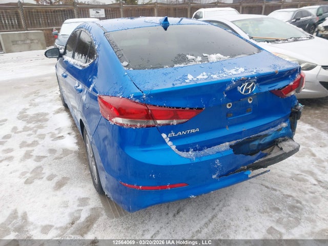 KMHD84LF4JU511279 Hyundai Elantra Sel/value/limited
