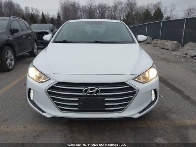 KMHD84LF1HU209779 Hyundai ELANTRA GL