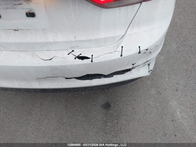 KMHD84LF1HU209779 Hyundai ELANTRA GL