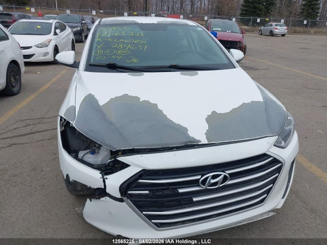 12565225 :رقم المزاد ، 5NPD74LFXJH284651 vin ، 2018 Hyundai Elantra Le مزاد بيع